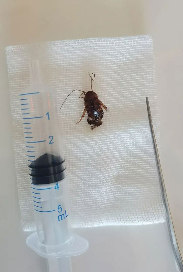 【提醒】睡梦中蟑螂爬进女子耳朵!医生:千万别这么做(图2) 2.jpg