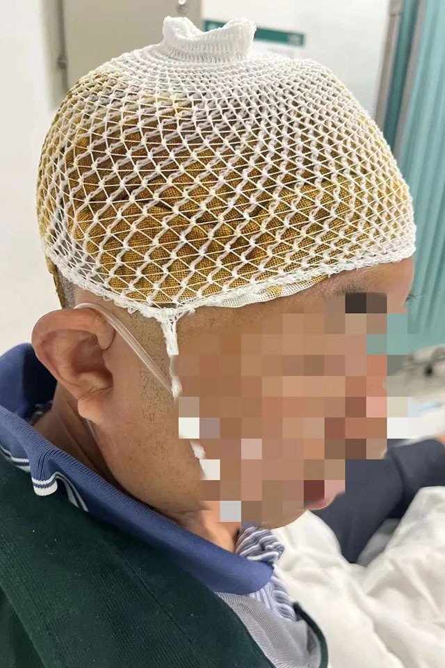 【围观】泸州男子被蛇“爆”头......