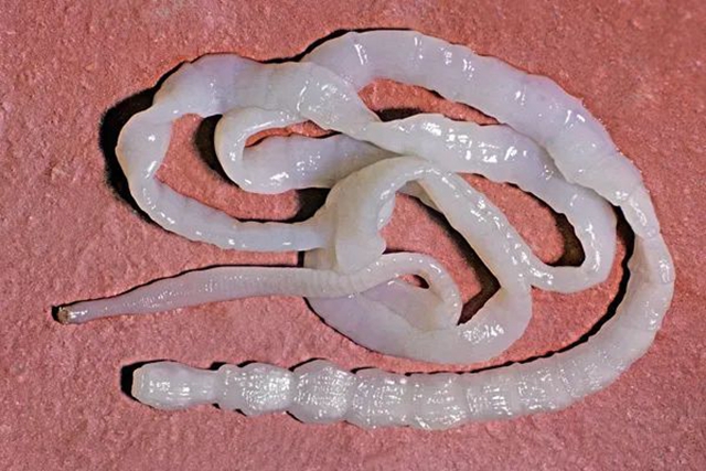 【惊讶】泸州男子带条虫来看病,yue……(图2) 2.jpg