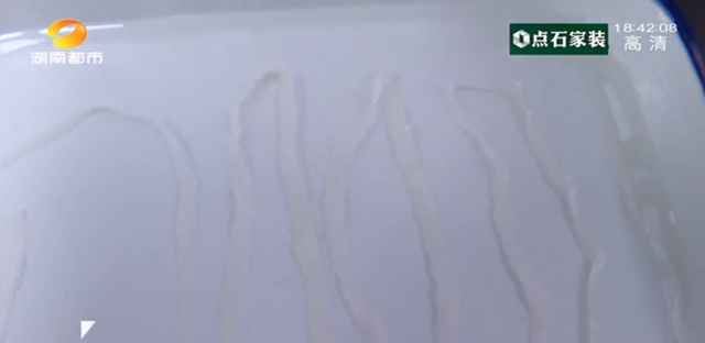 【惊讶】泸州男子带条虫来看病，yue……