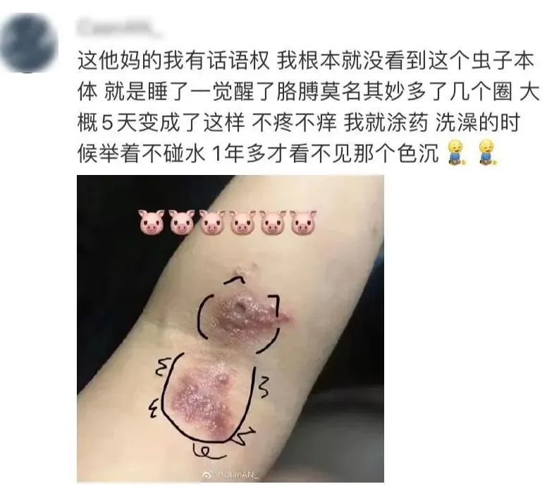 【围观】泸州女子差点毁容,竟是被虫子“泼硫酸”......(图14) 14.jpg