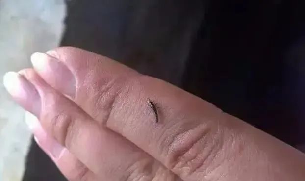 【围观】泸州女子差点毁容,竟是被虫子“泼硫酸”......(图15) 15.jpg