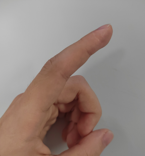 【围观】真正有效的祛疤办法，首先要这样做！