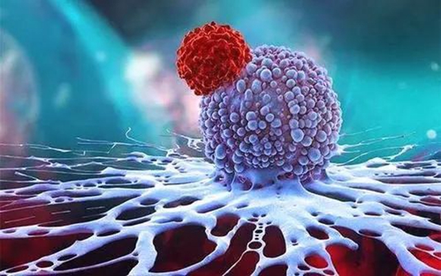 【围观】肺结节切除后，竟多发转移？