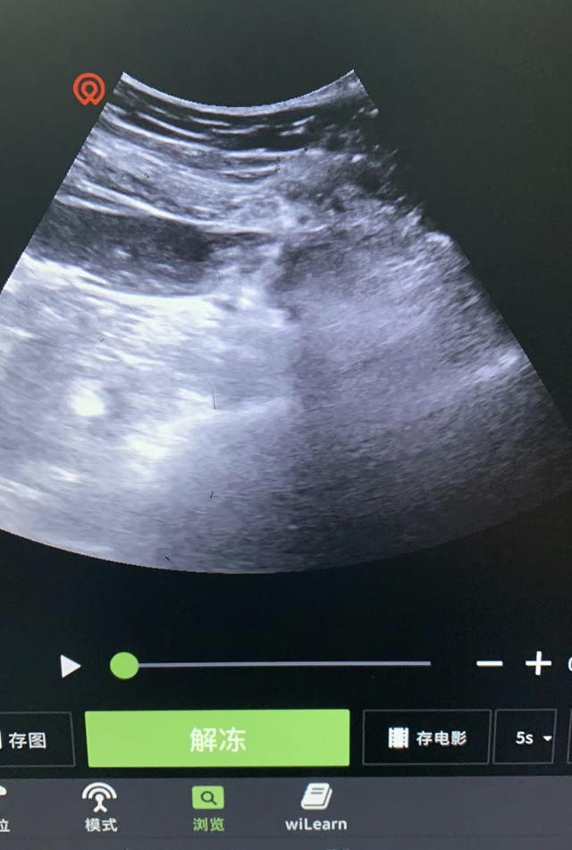 【围观】泸州嬢嬢大夏天穿秋裤,原因竟是……(图3) 640.png