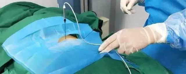 【围观】泸州嬢嬢大夏天穿秋裤,原因竟是……(图6) 640 (3).jpg