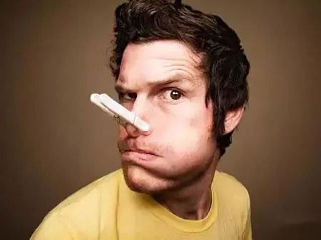 【围观】鼻塞,可能是鼻子里面弯了?(图4) 4.jpg