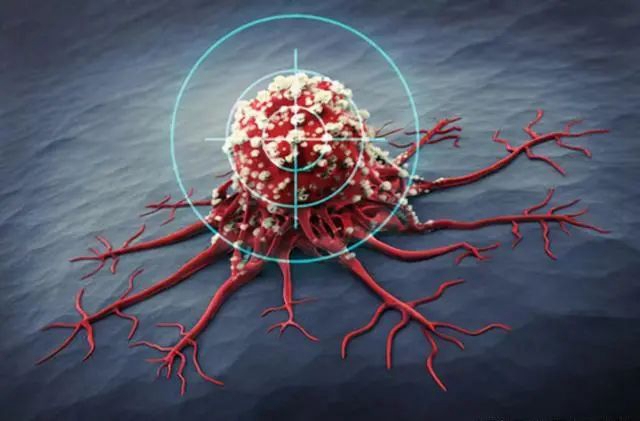 【围观】乳腺癌20年,83岁奶奶竟然……(图2) 微信图片_20231011091535.jpg