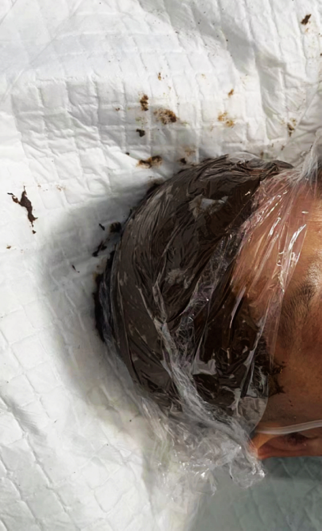 【围观】泸州嬢嬢被一群毒蜂ju了,病危……(图3) nEO_IMG_3.jpg