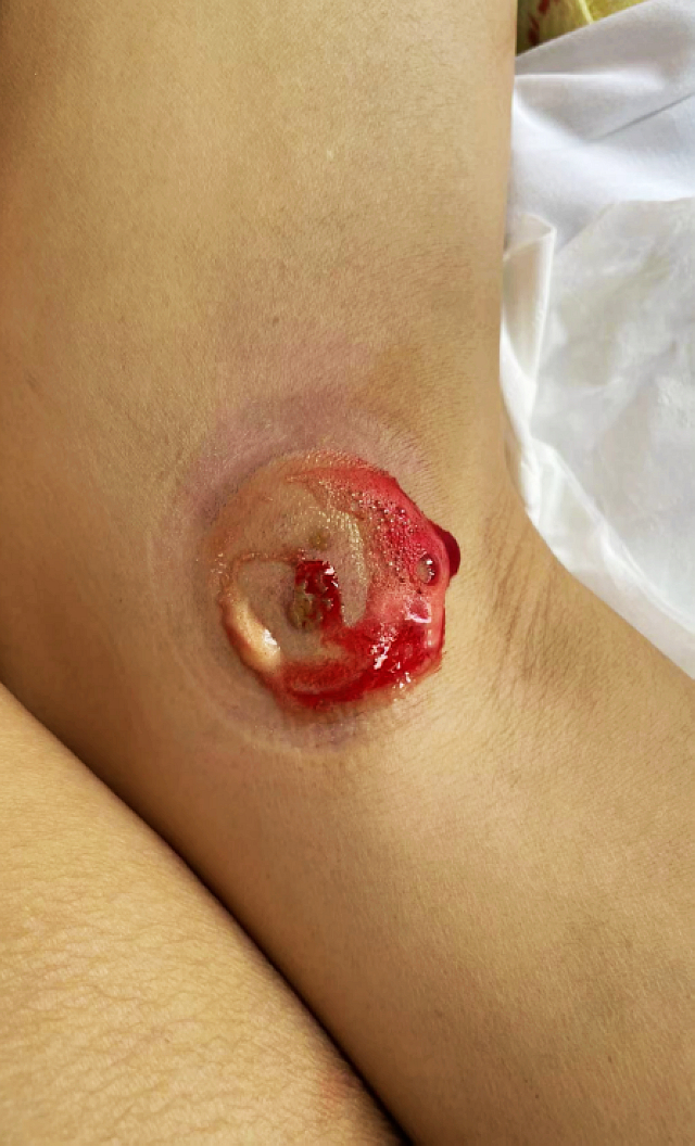 【围观】泸州嬢嬢被一群毒蜂ju了,病危……(图8) nEO_IMG_8.jpg