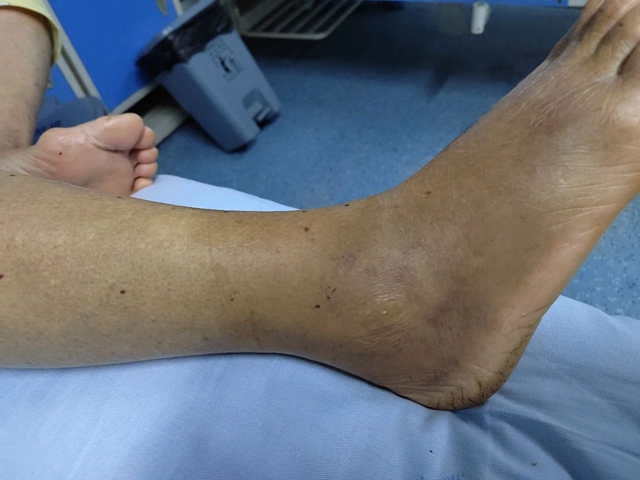 【警惕】泸州一天之内发生3起!医生表示:不可按照“民间流程”自行处理!(图3) 微信图片_20231019083843.jpg