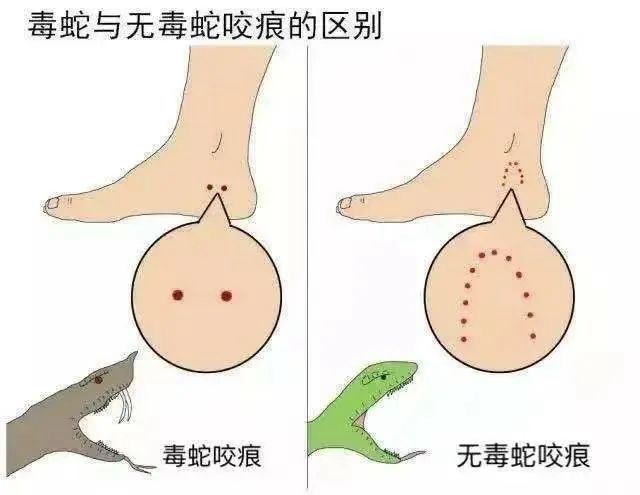 【警惕】泸州一天之内发生3起!医生表示:不可按照“民间流程”自行处理!(图6) 微信图片_20231019083900.jpg