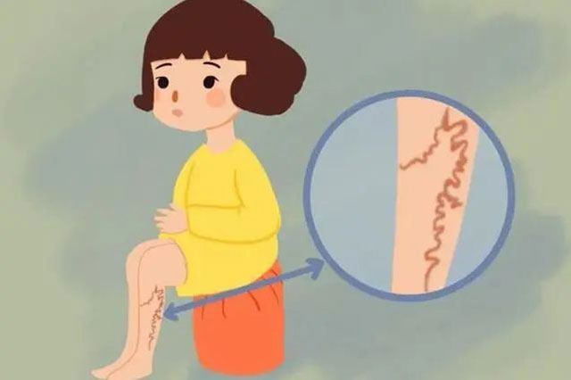 【围观】年纪轻轻,泸州男子双腿险些毁掉……(图6) 6.jpg