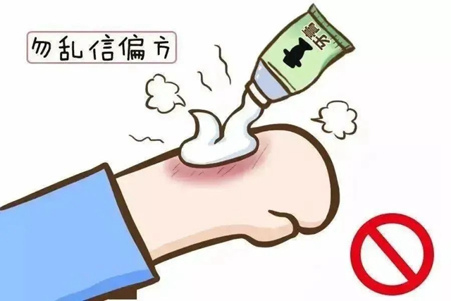 【围观】“脆皮大学生”,炸香肠炸出二度烫伤!(图4) 微信图片_20231023095700.jpg