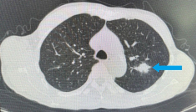 【围观】仅三个月,肿瘤就消失了,癌症有那么可怕吗?(图2) 微信图片_20231026092942.jpg