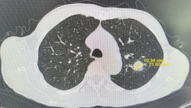 【围观】仅三个月,肿瘤就消失了,癌症有那么可怕吗?(图3) 微信图片_20231026092946.jpg