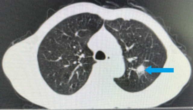 【围观】仅三个月,肿瘤就消失了,癌症有那么可怕吗?(图4) 微信图片_20231026092951.jpg