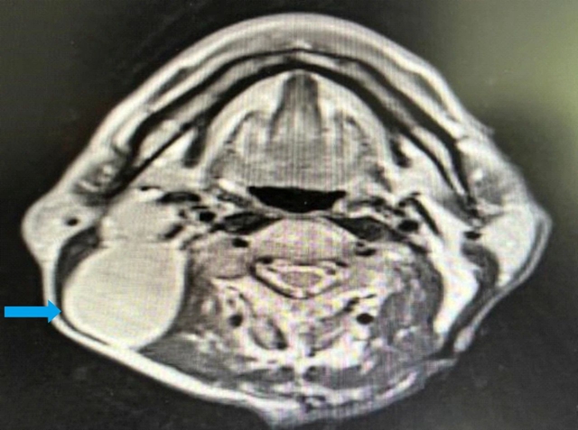 【围观】仅三个月,肿瘤就消失了,癌症有那么可怕吗?(图7) 微信图片_20231026093007.jpg