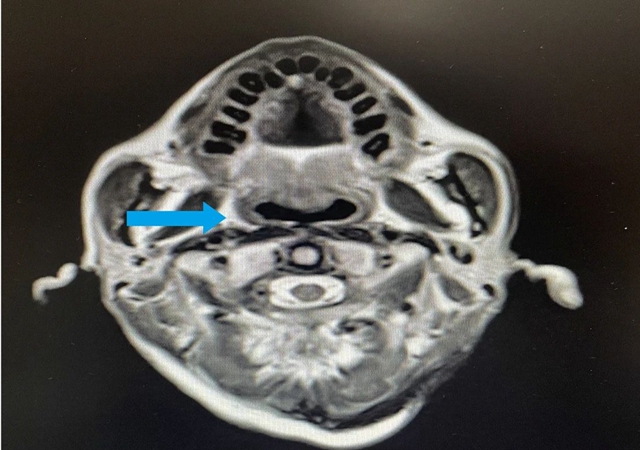 【围观】仅三个月,肿瘤就消失了,癌症有那么可怕吗?(图8) 微信图片_20231026093011.jpg