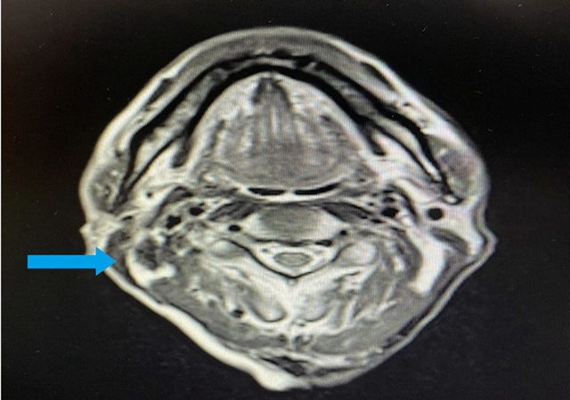 【围观】仅三个月,肿瘤就消失了,癌症有那么可怕吗?(图9) 微信图片_20231026093015.jpg