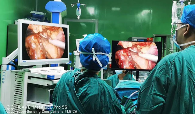 泸州福欣医院成功开展“腹腔镜+胃肠镜联合胃癌根治术”!(图3) 3.jpg