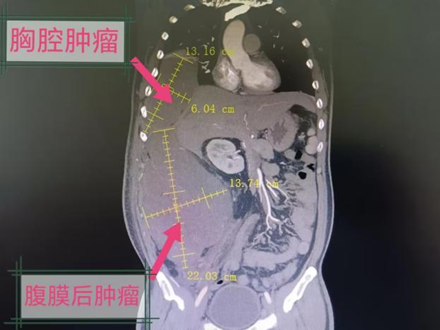 微信图片_20231113101541.png