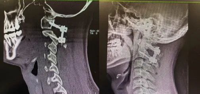 【围观】泸州的士司机深夜遇险