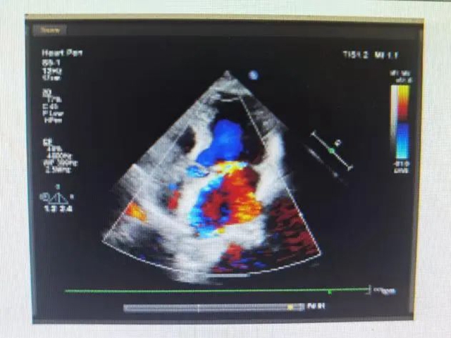 什么？做个手术竟成了别人“羡慕”的对象……