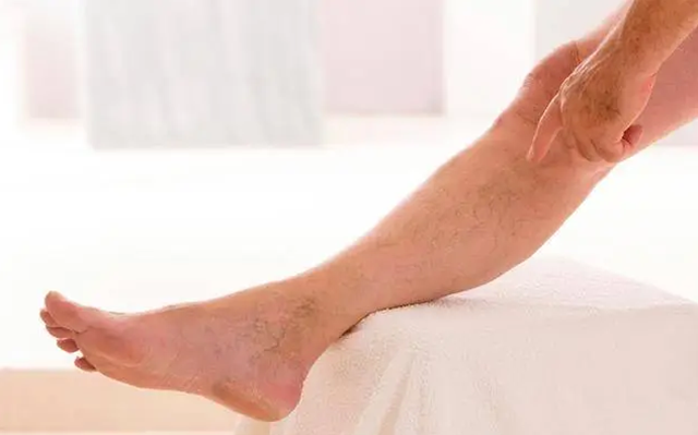 【扩散】腿脚冰凉的人注意了,严重可能截肢!(图4) 微信图片_20240124092114.png