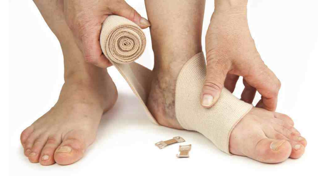 【扩散】腿脚冰凉的人注意了,严重可能截肢!(图5) 微信图片_20240124092119.png