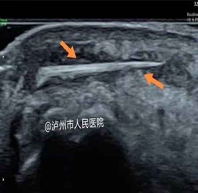 微信图片_20240205091538.jpg