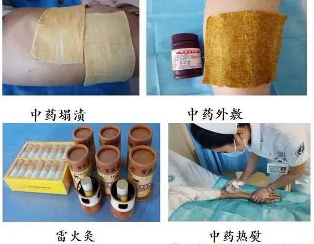 【关注】可怕的“蛇缠腰”,缠满一圈就会死人吗?(图12) 微信图片_20240209092905.jpg