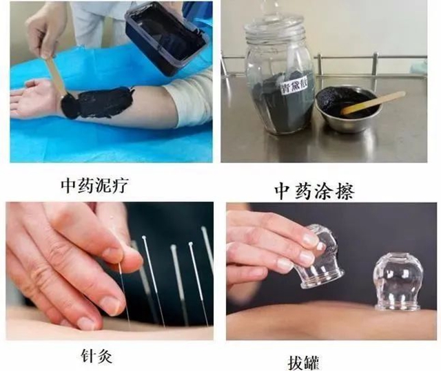 【关注】可怕的“蛇缠腰”,缠满一圈就会死人吗?(图13) 微信图片_20240209092910.jpg