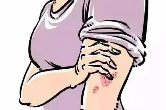 【关注】可怕的“蛇缠腰”,缠满一圈就会死人吗?(图15) 微信图片_20240209092919.jpg