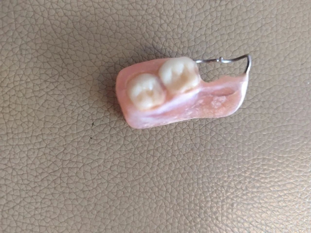 泸州七旬老人到医院“找牙”，却捡回一条命