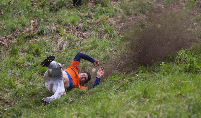 【惊险】摔伤致大出血，硬核男子独自跑回家……
