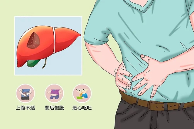 【警惕】肝上长满密密麻麻的小水泡?(图3) 微信图片_20240312090521.jpg