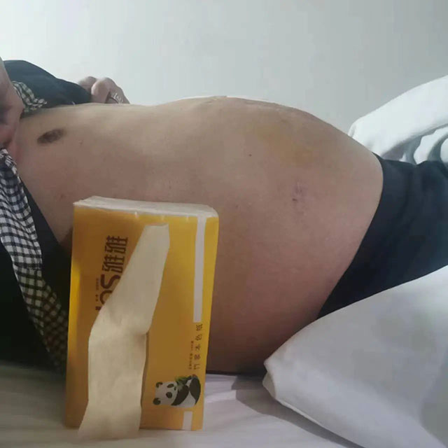 【围观】服下毒药，泸州男子一晚上拉了60次......