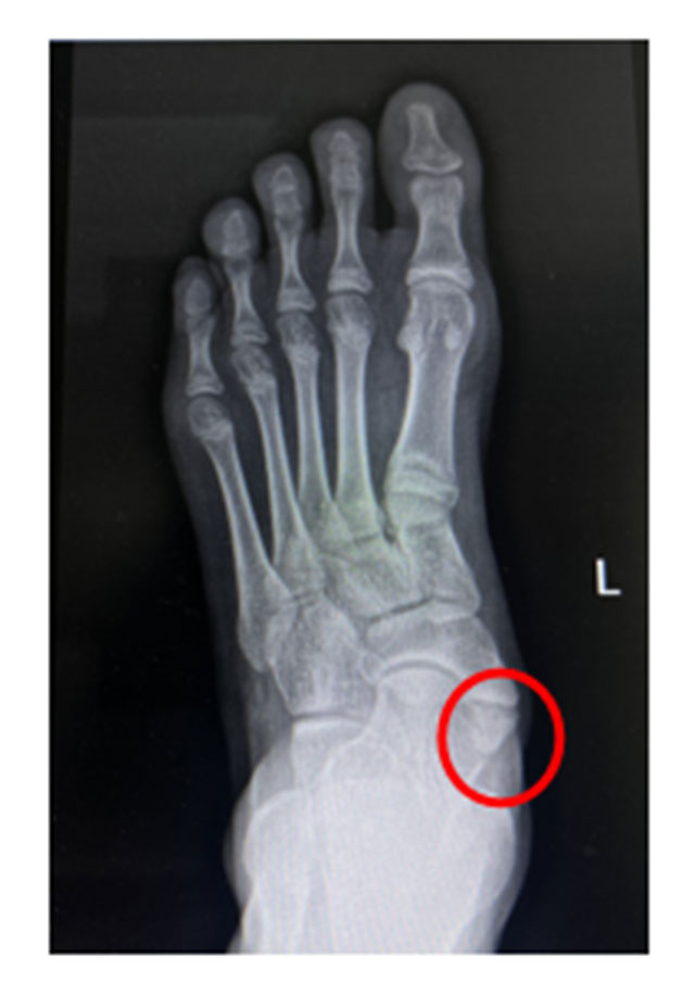 【围观】泸州一初中生体考前疼痛难忍......