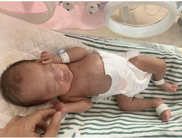 【围观】极早产儿！出生仅两斤……