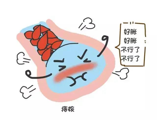 【关注】泸州一初中生一个痔疮引发严重贫血，晕倒在厕所！