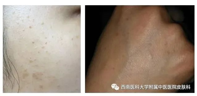 毒６.jpg