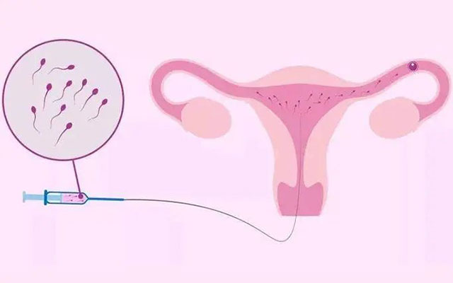 【好消息】首个!西南医大中医院“夫精人工授精”宝宝出生啦(图4) 4.jpg