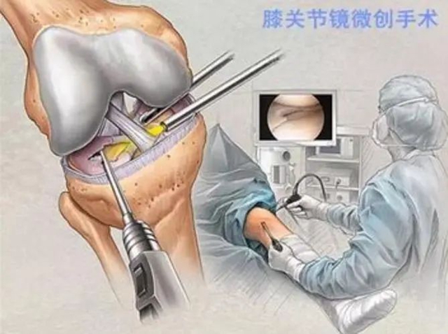 【围观】克膝头儿痛了近20年,一周就好了(图3) 微信图片_20240620102053.jpg