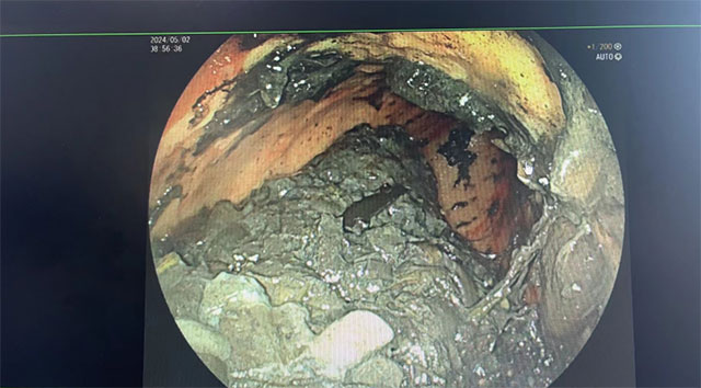 【围观】男子头痛粉上瘾，每天40包