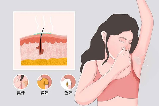 【科普讲堂】这个夏天，来和腋臭做个了断吧！