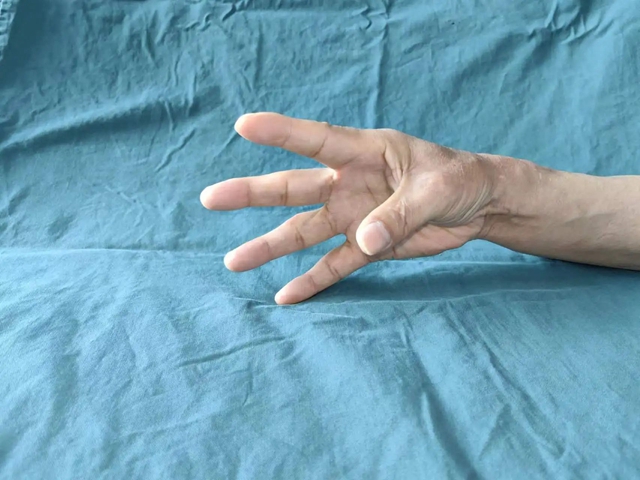 【围观】泸州男子整个右手臂被卷入传送带……