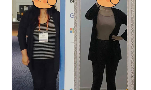 【关注】202斤女大学生,减肥手术成功!(图7) 6.jpg