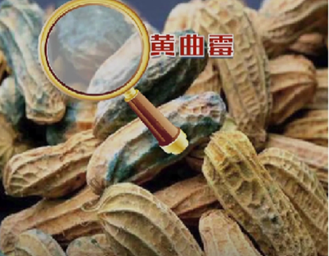 【技术】“介入+靶免”强强联合,为肝癌患者带来新“生机”!(图2) 肝2.jpg