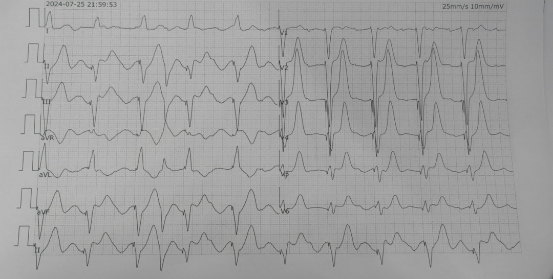 紧急!泸州大爷心脏停跳,“生死时速”助其“心”生(图2) 2.png